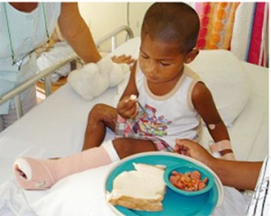 Nandesh, a victim of the careless use of fireworks during Diwali 2004, was burnt while sleeping in his bed. Here he is seen recovering from the second of three operations in 2006.