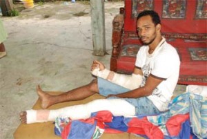 Keith Bowen at his Albouystown home on Thursday with his injuries sustained after the beating. (Jules Gibson photo)