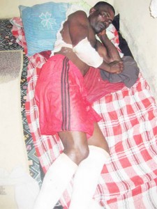 Munilall Ganpat lying in his relatives’ home with bandages to his feet, back and hand.