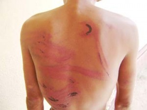 Photos of the men showing marks of violence