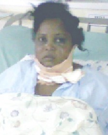 The battered Sharmin McKay in her hospital bed yesterday