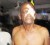 Businessman Winston Miller will have to seek overseas medical attention for his injured eye. He was gun butted and repeatedly kicked by police at his night club in Bartica after a rank because infuriated when he was refused entry when he did not pay the $1000 entrance fee.