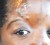 In this photograph one of the screws can be seen protruding from Malica’s forehead.