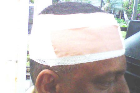 Ramcharitar Singh’s bandaged head. He was gun-butted when gunmen invaded his home on Sunday night.