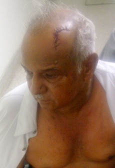 Albert Subhan shows the wound to his head