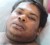 One of the victims of the piracy attack at the Charity hospital yesterday. He has been identified only as Singh of Devonshire Castle, Essequibo Coast.