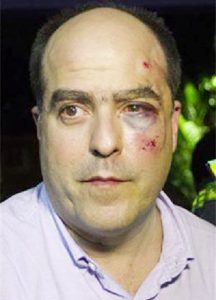 Venezuelan opposition lawmaker Julio Borges of the Primero Justicia party arrives at a news conference with a bruised and bloodied face after a fight broke out at a session of the National Assembly in Caracas April 30, 2013. (Reuters/Carlos Garcia Rawlins)