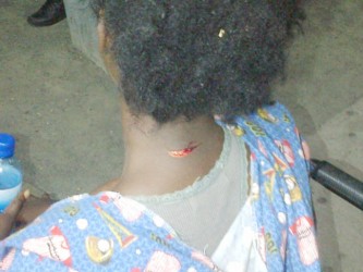 A deep gash is left at the back of Stacia’s neck after her child’s father hit her there several times with glass louvers