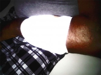 The bandaged arm of Parachandra Harriprasad following last evening’s attack