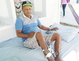 Rajendra Samnarine showing his injured foot