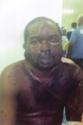 Kwame Bhagwandin  after the attack