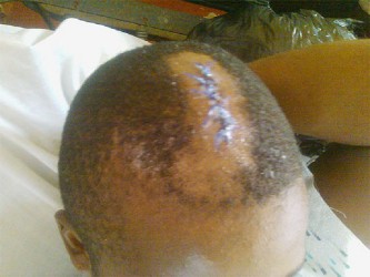 The wound in Terrence Welch’s head 