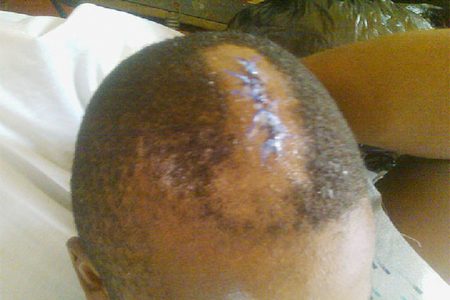The wound in Terrence Welch’s head 