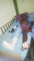 An injured Clinton Gobin at the Georgetown Public Hospital yesterday afternoon. 