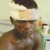 A bandaged Sudesh Mears in the hospital