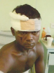 A bandaged Sudesh Mears in the hospital 