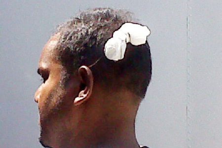 Asif Masode Khan’s bandaged head
