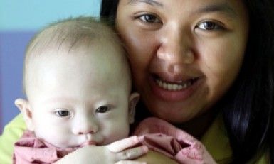 Baby Gammy, who was abandoned after it was discovered that he had Down syndrome.