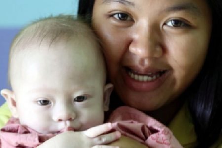 Baby Gammy, who was abandoned after it was discovered that he had Down syndrome.
