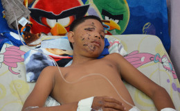 The injured Reba Ganesh, 12