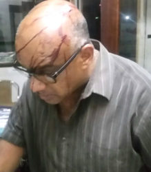 A security guard, Kadarnauth, showing his injuries after the attack 