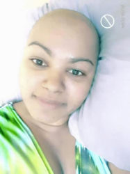 Devika Tinsarran after she lost all her hair due to chemotherapy treatment for breast cancer. 