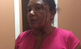 Gail Atkinson after the attack