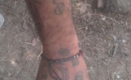 The tattoos on the young man’s arm. Despite his success in the entrance exam, the army has said that he would not be accepted in unless the tattoos are removed.
