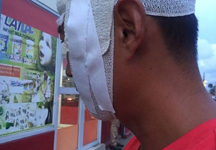 Jason Wang’s bandaged head after the attack.
