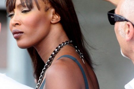 Supermodel Naomi Campbell is seen as the ‘poster girl’ for receding hairline.