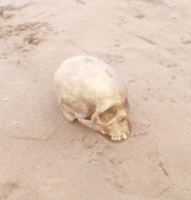 The skull that was found near the Wismar-Mackenzie Bridge. (Guyana Police Force photo)
