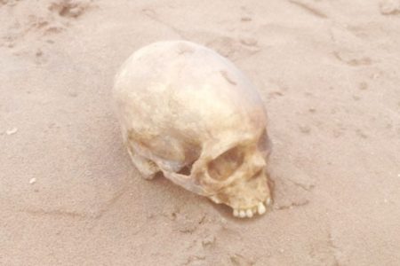 The skull that was found near the Wismar-Mackenzie Bridge. (Guyana Police Force photo)
