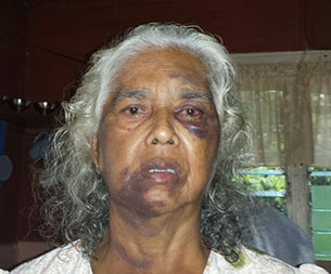 Bhagwandai Deonarine two years ago after she was beaten