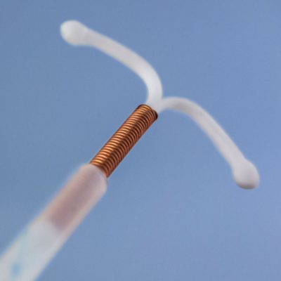 A photograph of a intrauterine device (IUD).