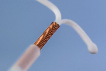 A photograph of a intrauterine device (IUD).