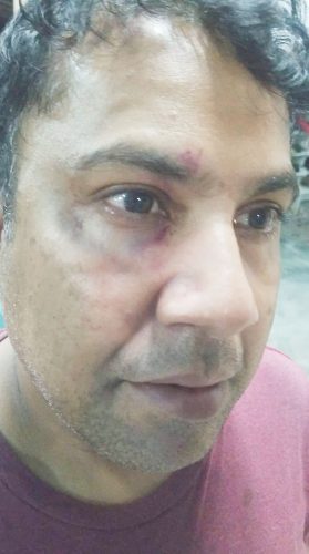 Ramkarran Luckicharran was hit to his head and face by the men and said he suffered injuries to his eyes
