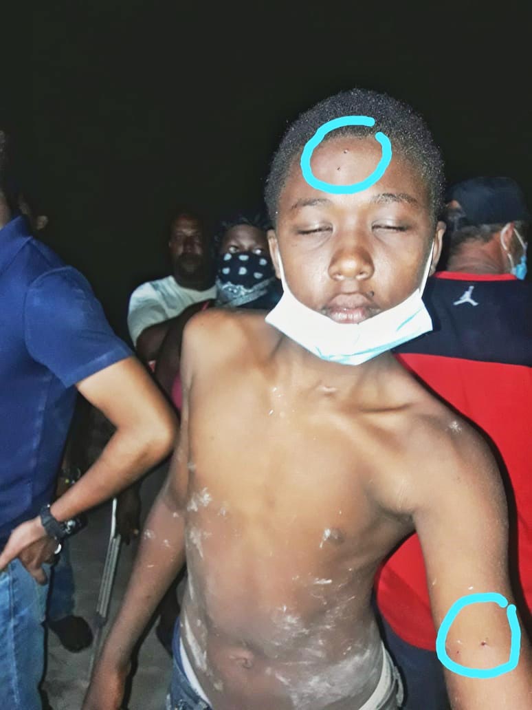 This boy was struck by pellets