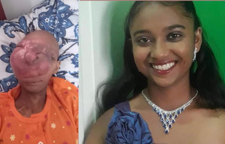 A composite photo shows Shaniece Nanhoe after and before the facial cancer growth