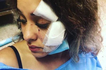 Izzy Rawshdeh sustained injuries to her face and had to be taken to receive medical assistance at hospital.
