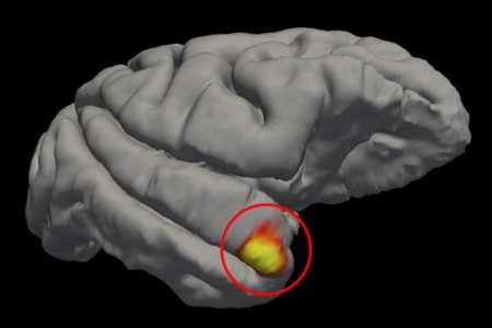 An area (circled) in the brain’s temporal pole specializes in familiar face recognition. Credit: Sofia Land