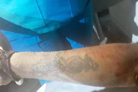 The tattoo on the right forearm of the deceased
