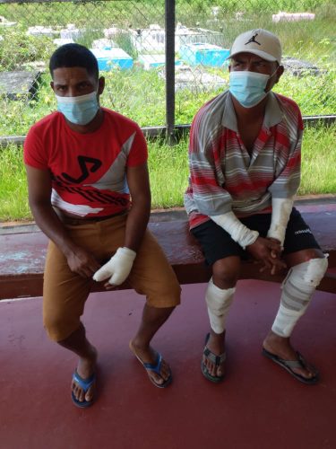 From left are Derrick Balmickery, 29, and Phillip Edmonds, 42, with bandages over the burns they suffered as a result of the fire (GFS photo)
