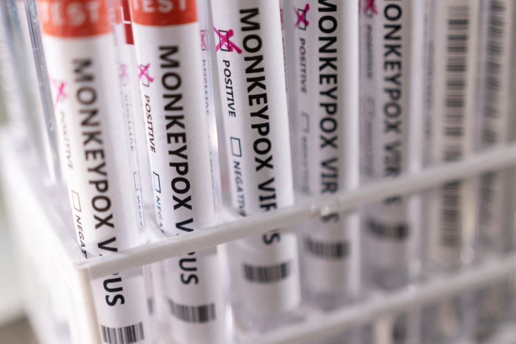 FILE PHOTO: Test tubes labelled "Monkeypox virus positive" are seen in this illustration taken May 22, 2022. REUTERS/Dado Ruvic/Illustration/File Photo
