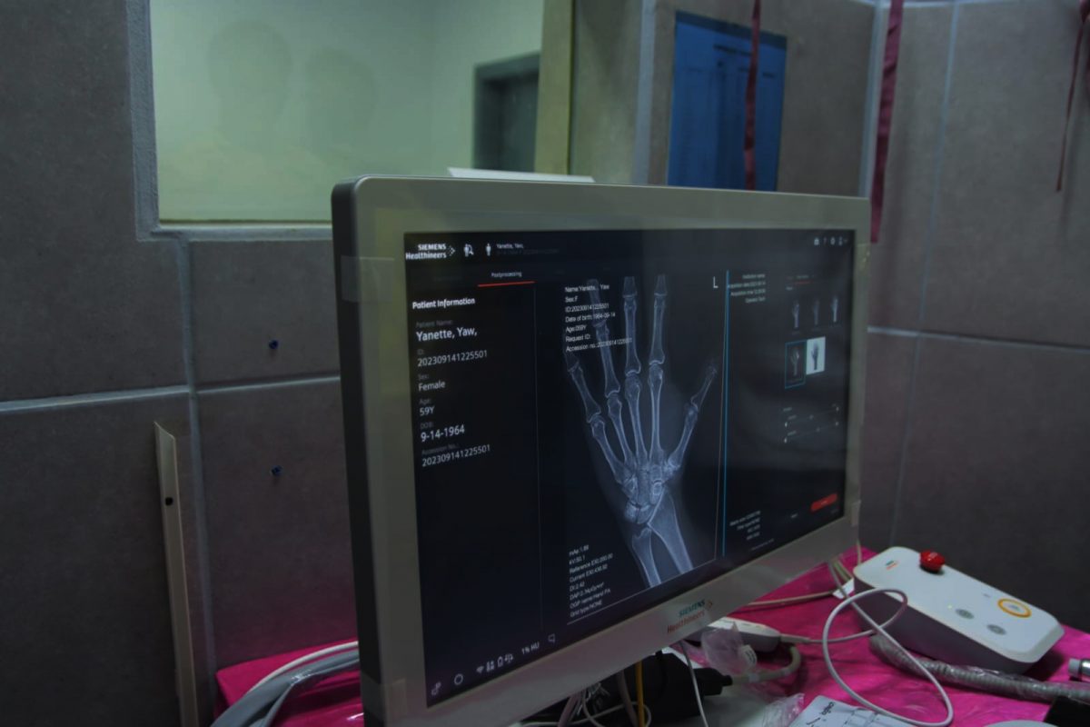 A digital X-ray image shown at the Port Mourant  Hospital (Ministry of Health photo)