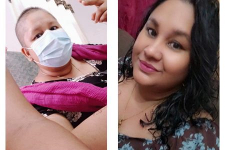Sylvia Diaz during and after treatment 