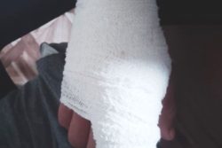 Images showing the 13-year-old’s injured hand. 