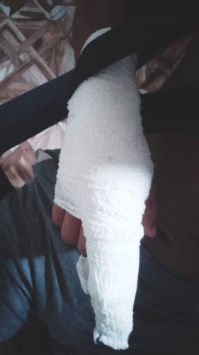 Images showing the 13-year-old’s injured hand. 